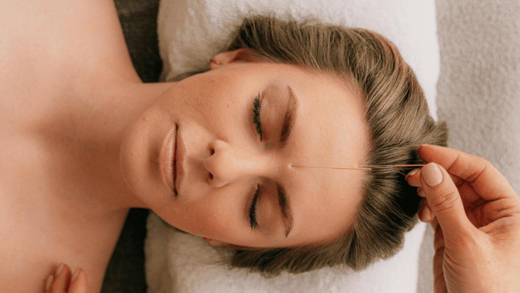 Gesichtsakupunktur_3 | Treatwell